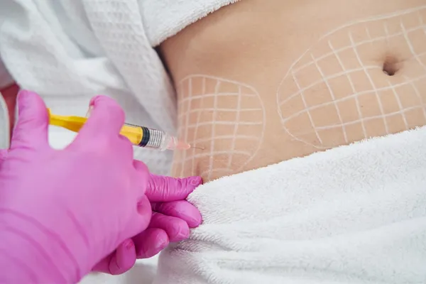 Fat Dissolving Injections