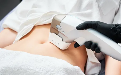 Laser Contouring