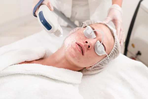 Pigmentation Reduction