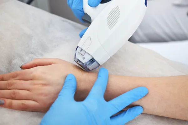 Vascular Lesion Treatment