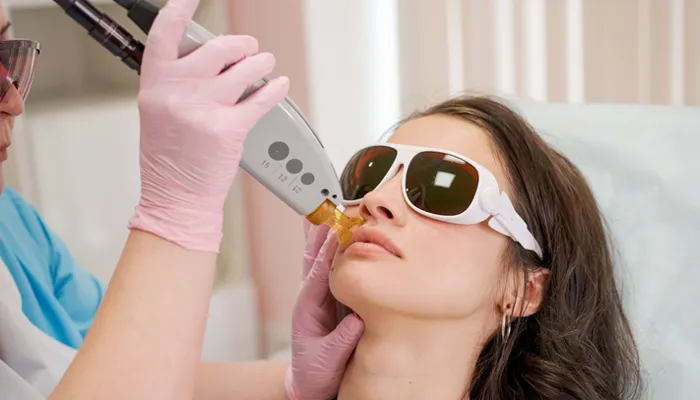 Laser Lip Rejuvenation